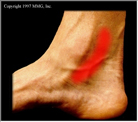 Foot